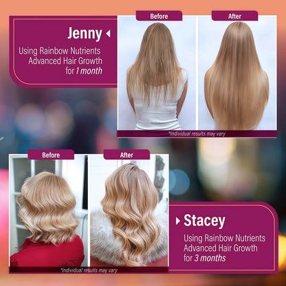 Hair Growth Vitamins for Women | Biotin 10,000mcg, Collagen, Patented OptiMSM®, goMCT®, Saw Palmetto | Naturally Supports Stronger & Healthier Hair, Skin and Nails |Non GMO + Made in USA|60 Day Supply