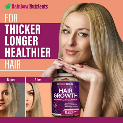 Hair Growth Vitamins for Women | Biotin 10,000mcg, Collagen, Patented OptiMSM®, goMCT®, Saw Palmetto | Naturally Supports Stronger & Healthier Hair, Skin and Nails |Non GMO + Made in USA|60 Day Supply